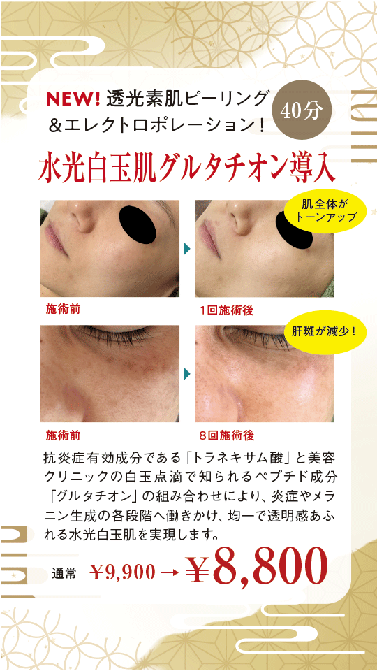 新コース！透光素肌ピーリング＆エレクトロポレーション！ | 水光白玉肌グルタチオン導入 | 通常￥9,900→￥8,800（40分） | 抗炎症有効成分である「トラネキサム酸」と美容クリニックの白玉点滴で知られるペプチド成分「グルタチオン」の組み合わせにより、炎症やメラニン生成の各段階へ働きかけ、均一で透明感あふれる水光白玉肌を実現します。