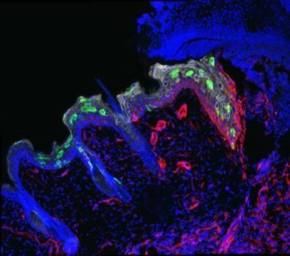 Stem cells (green) migrate into a three-day-old wound to repair it.