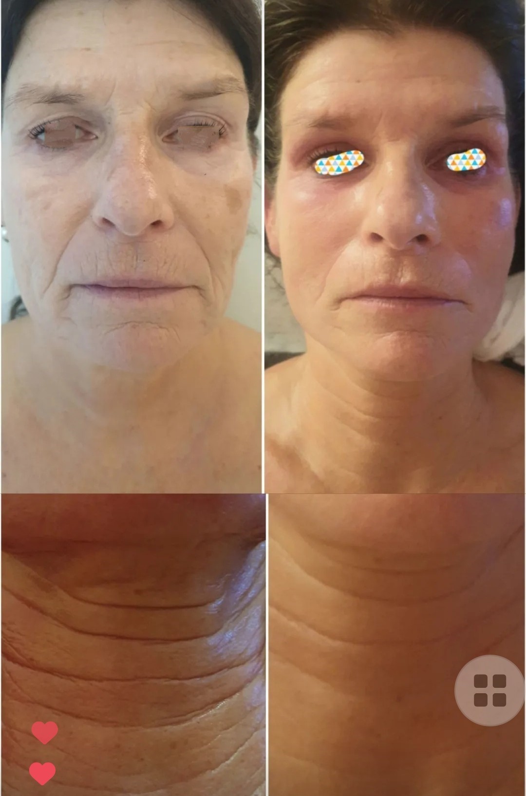  FaceDesign - 2 Jahre regelmäßige Treatments im Kosmetikinstitut Villa Kirnach