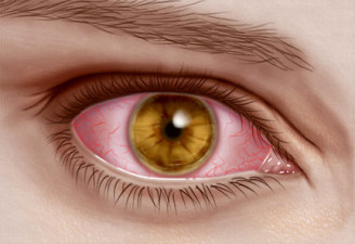 A Red-eye flight の意味