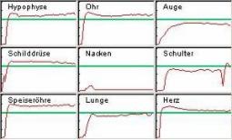 Auszug einer Biofeedback-Messung