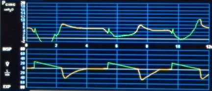 同調性が悪い時にどこを直したらいいのか悩む事が多いのでいくつか症例 シナリオ をあげて頂けるとうれしいです Jwerc ページ