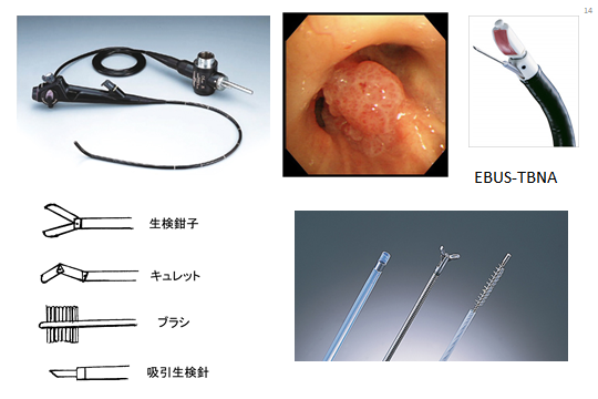 肺がんの診断 - 呼吸器ドクターNのHP