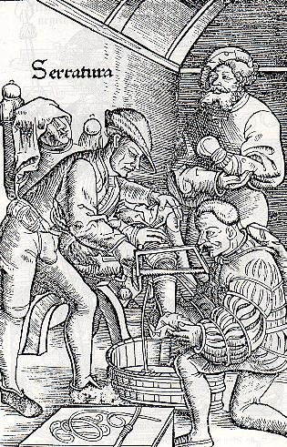 Scène d'amputation tirée du livre du chirurgien Hans von Gersdorff, publié en 1517.