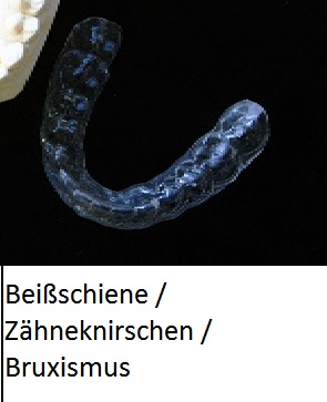 Zahnschutz über die Zähne bei Zähneknirschen