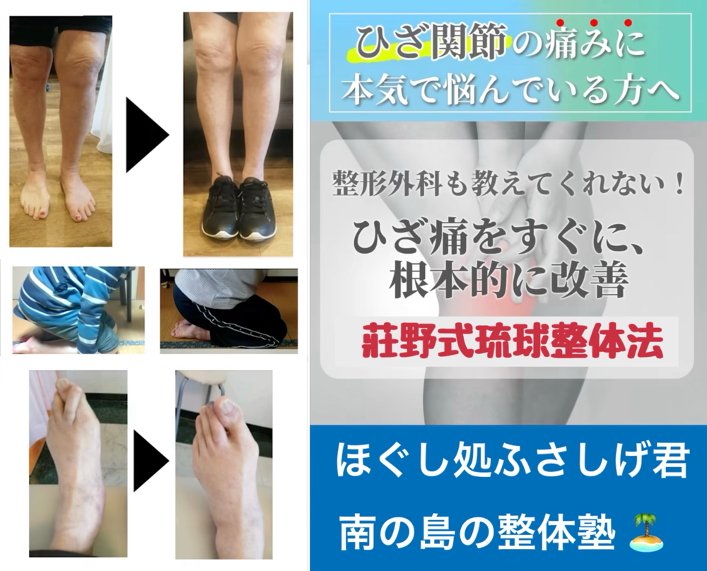 手術したけりゃ整形外科へ、したくなけりゃふさしげ君へ