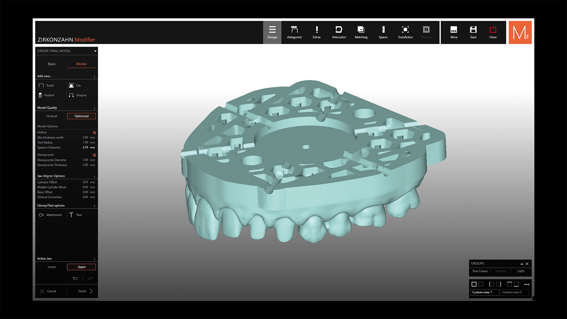 STEP 8 ベースを選択すると、ソフトウェアが模型内に対応するアタッチメントを自動生成します。