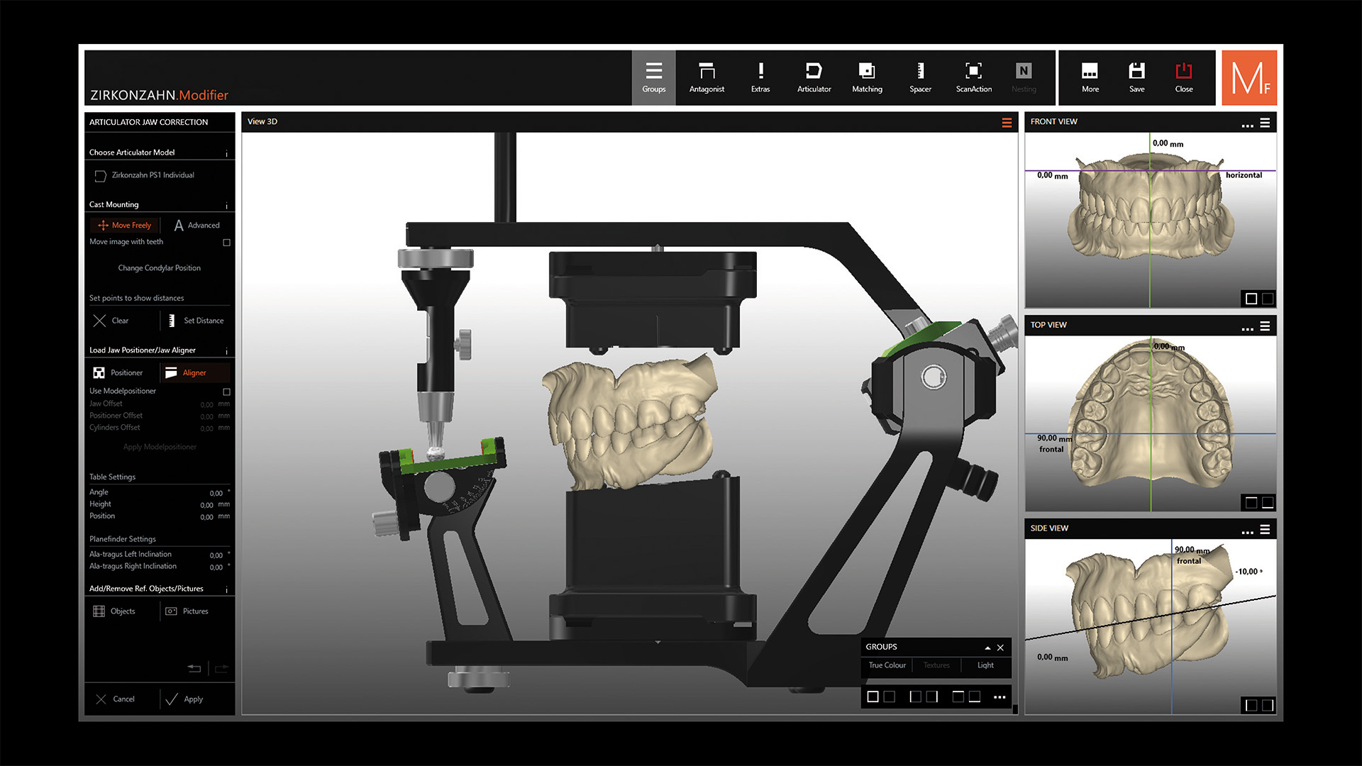 STEP 7 模型の条件に応じてスペーサープレートを組み合わせることで、模型プリント時のレジン使用量を抑えることができます。