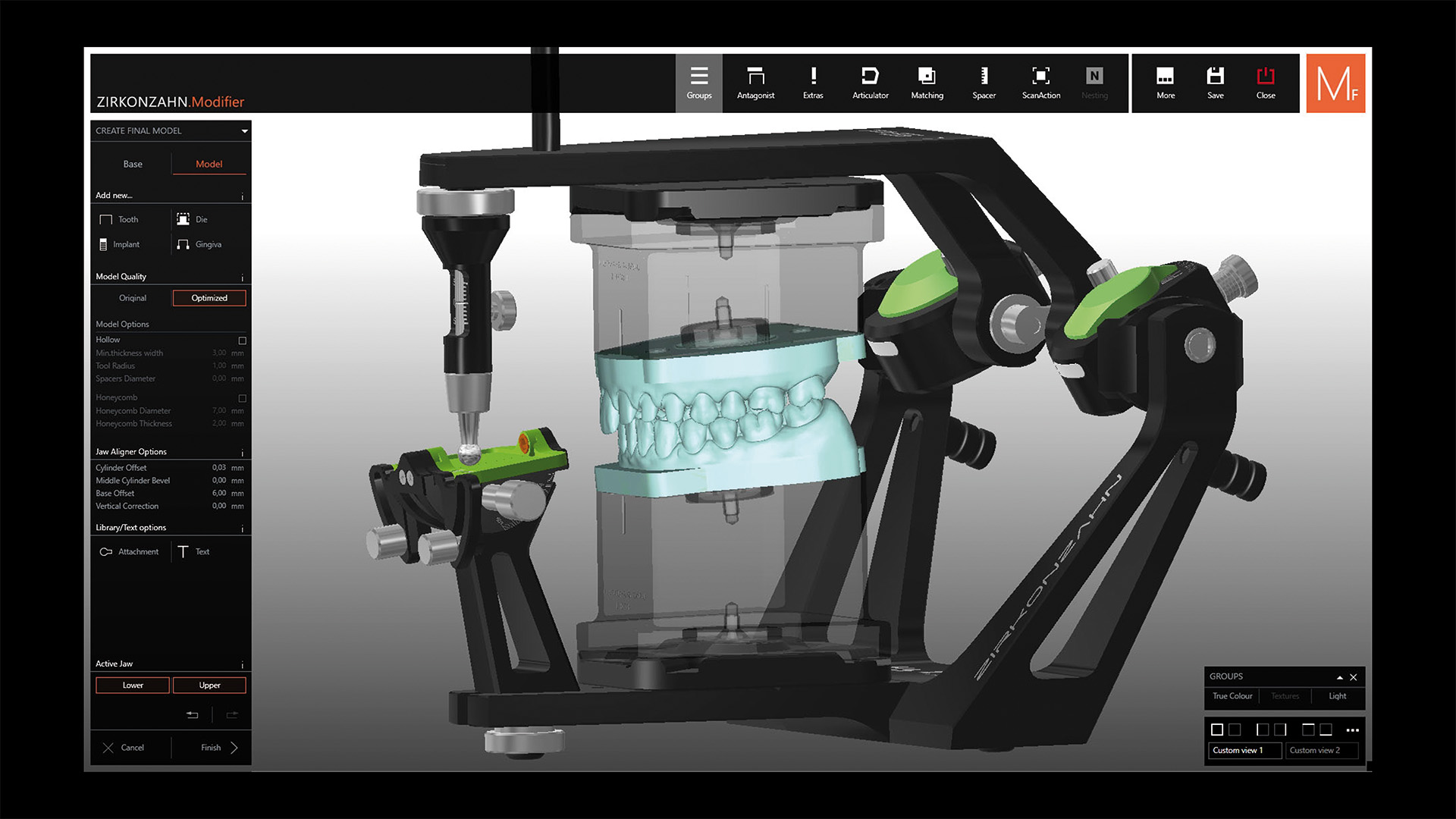 STEP 9 スペーサープレートと模型の間に設定を行うことができます。ベベル（面取り）の追加、ベース厚の調整、アタッチメント部の形状変更、積層誤差の補正などが可能です。