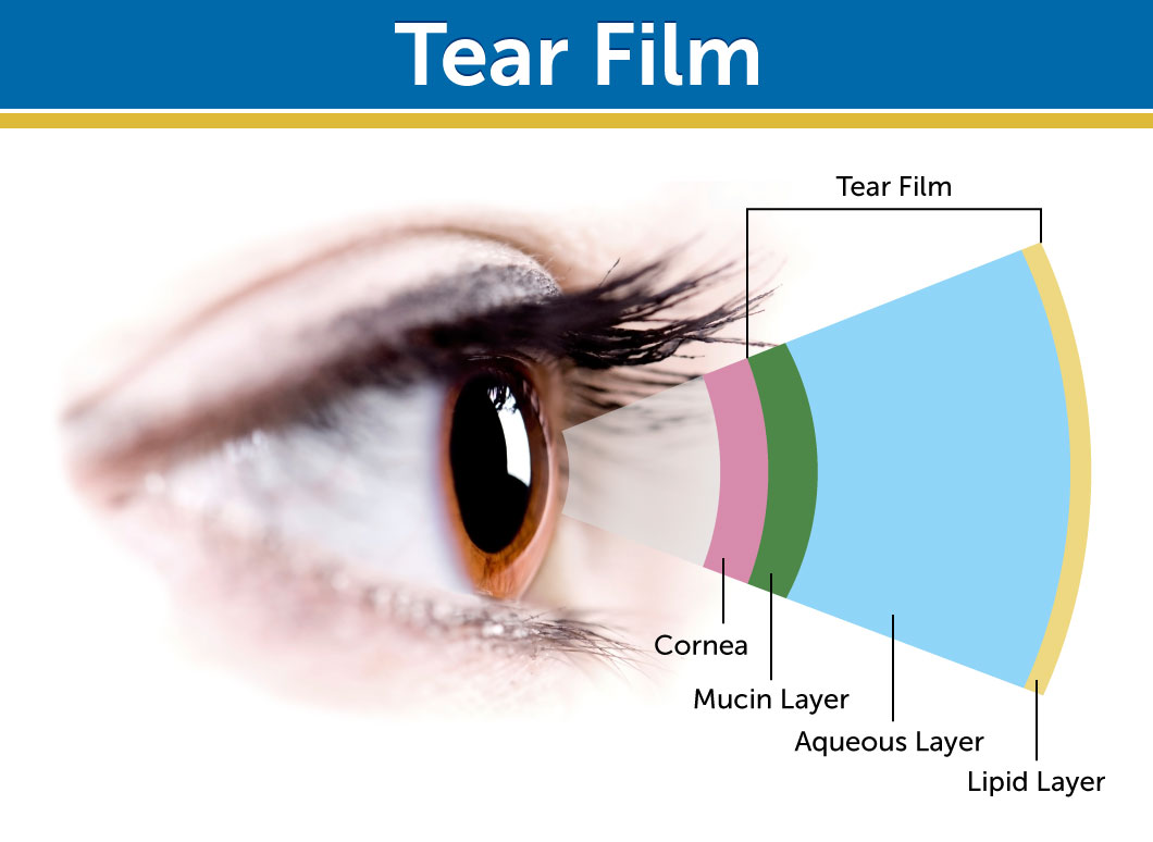 What are the contact lenses on the tear film?. Above crease. Soothe глазные капли. поливинилалкоголь eye drops. блинк интенсив.