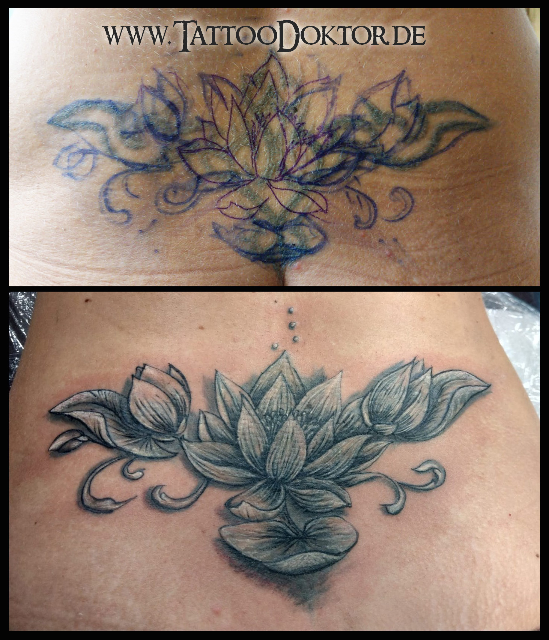 Informationen Zu Tattooentfernung Tattooritual Tattooritual Dein Tattoodoktor Fur Cover Up Im Norden