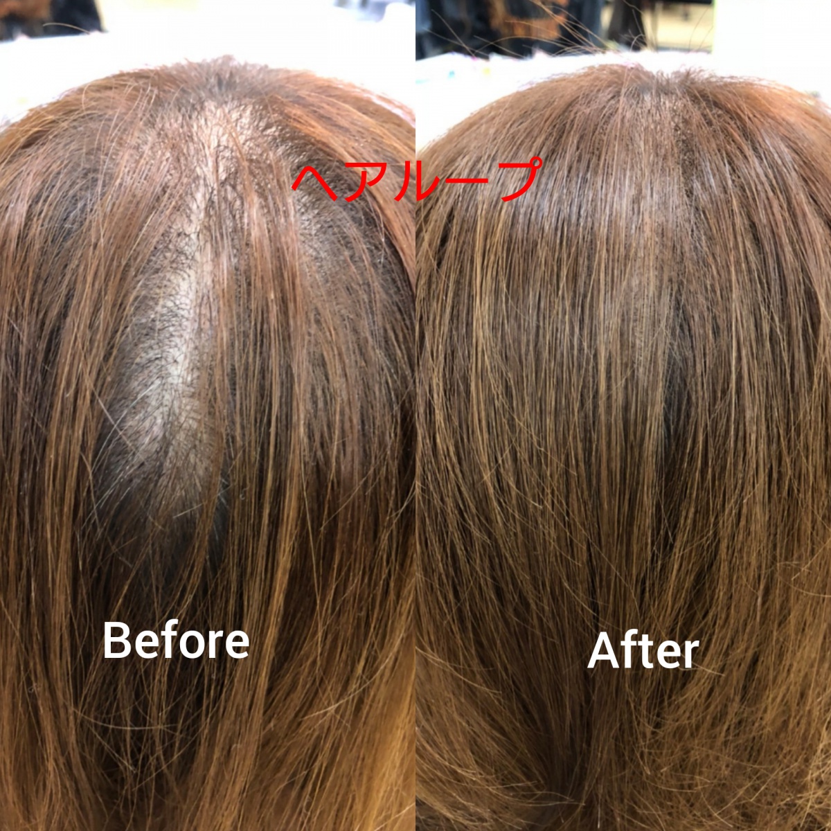 ヘアループ