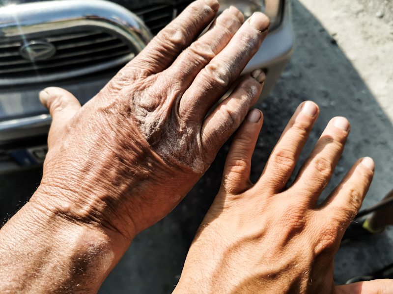 My hands vs proper hands of someone that is hand milking several dozen sheep and goats twice a day 