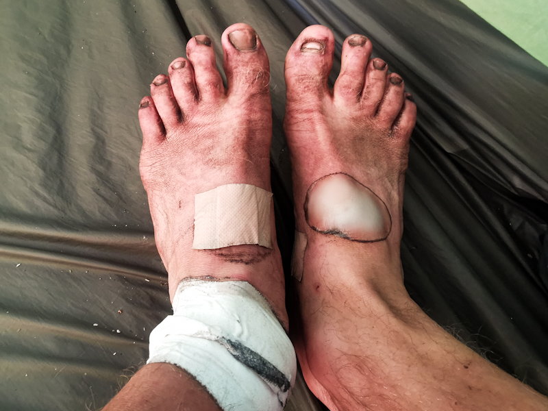 My feet after yesterday's hard day. They look worse than they feel.