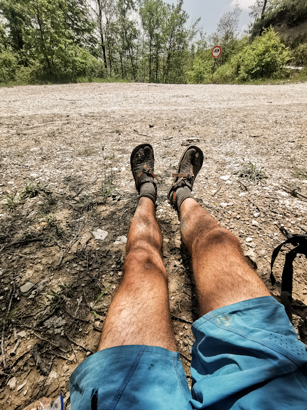 Battered legs and shorts 