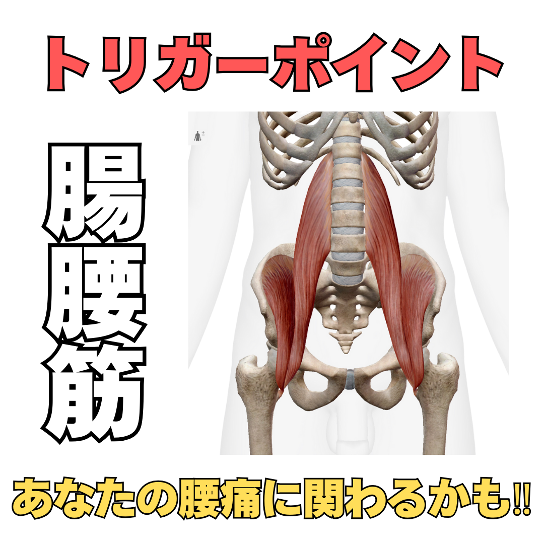 あなたの腰痛に関わるかもしれない腸腰筋のトリガーポイント