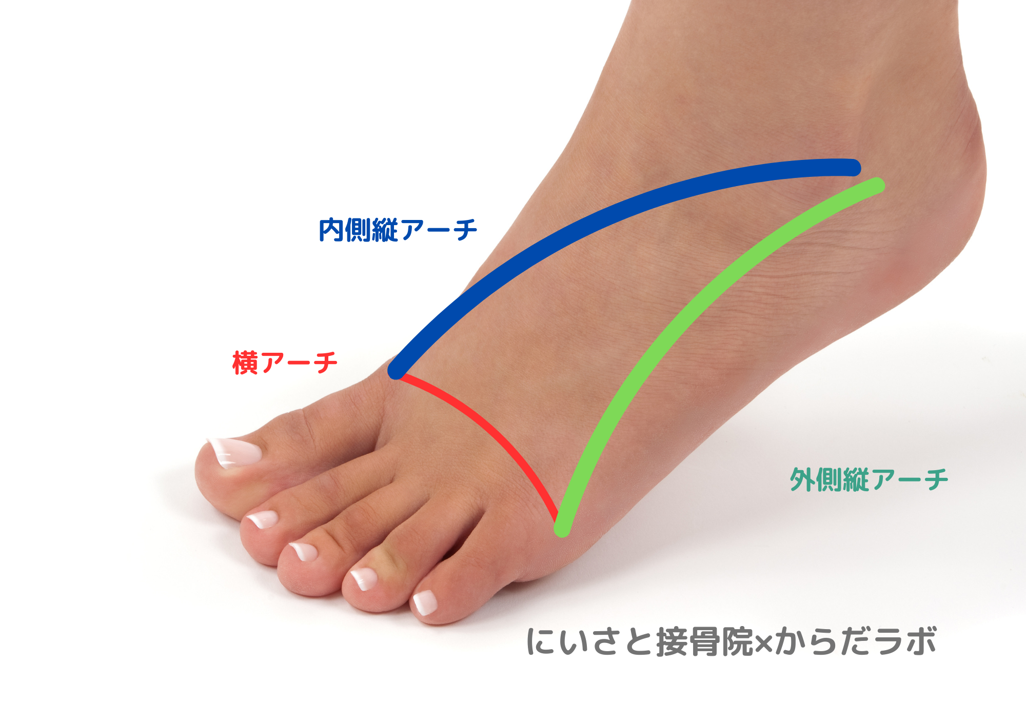 足のアーチの問題について分かりやすく解説【偏平足・開帳足・回内足・ハイアーチ】