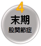 末期股関節症