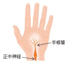手根管の場所