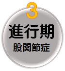 進行期股関節症