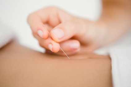 Therapeutin hält eine Akupunkturnadel über der Haut des Patienten - kurz vor dem Einstich.