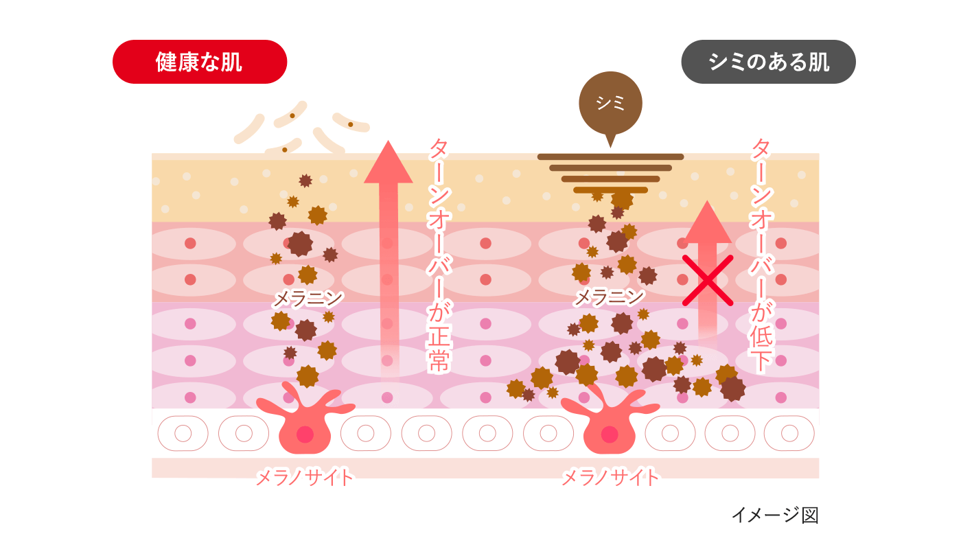 シミが薄くなるしくみ