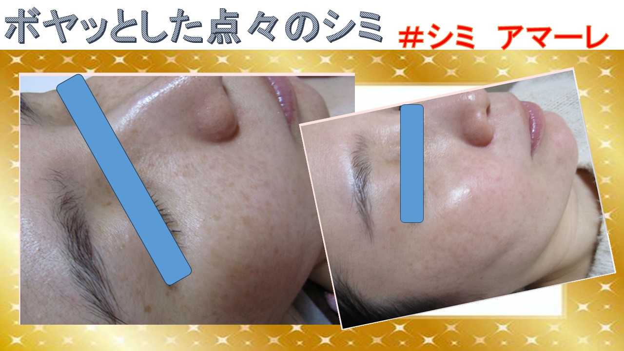 ぼやけたようなシミが一つひとつ薄く・・・