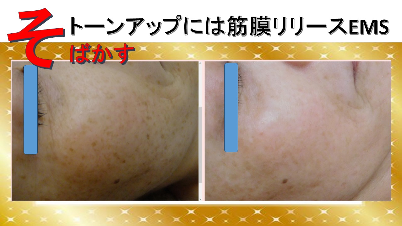 そばかす・くすみ・にお悩みのあなたへ