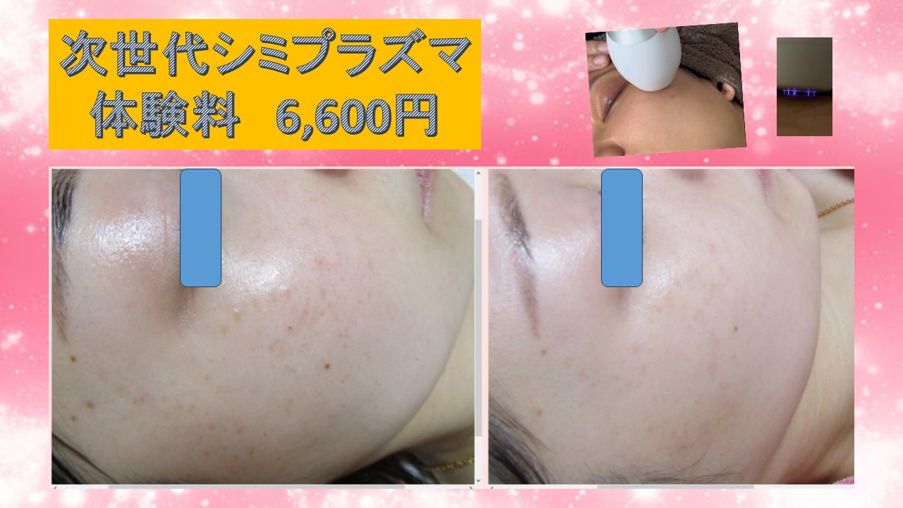 次世代シミプラズマ体験されましたか