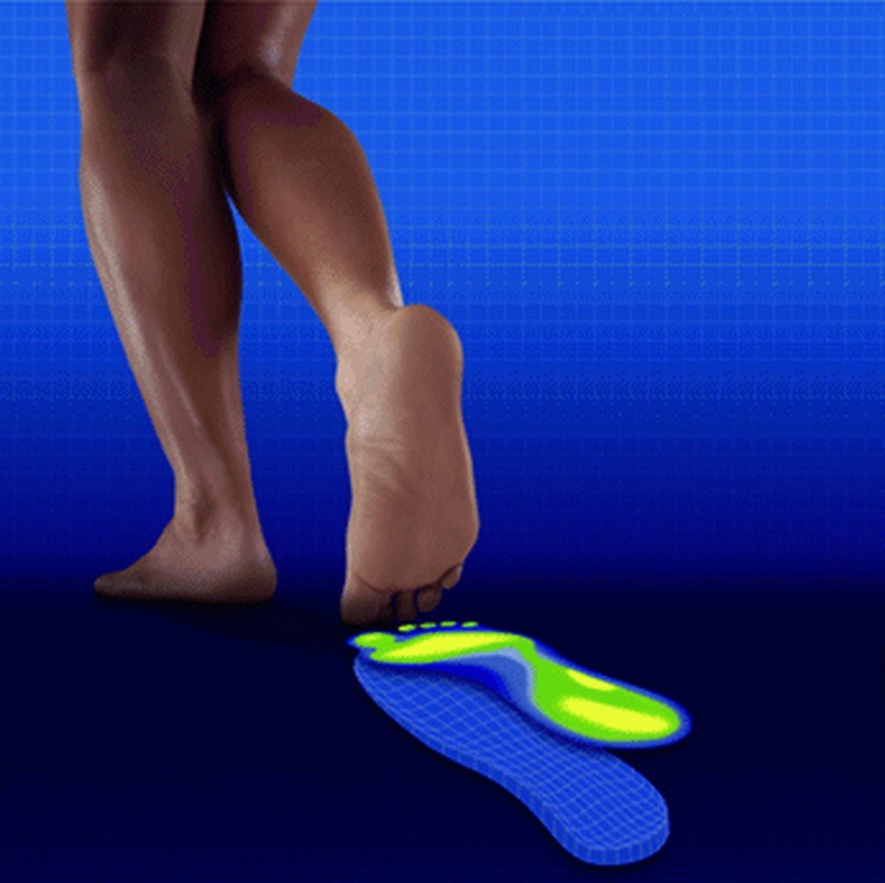 Sesamoiditis Myfootsteps Webseite