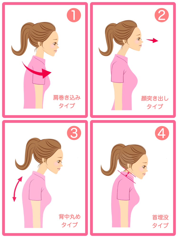 ★ 上半身の4タイプのどれか、または複合タイプ
