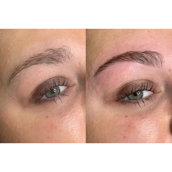 Restructuration des sourcils