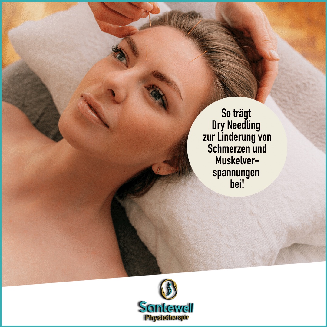 Dry Needling Therapie Physio