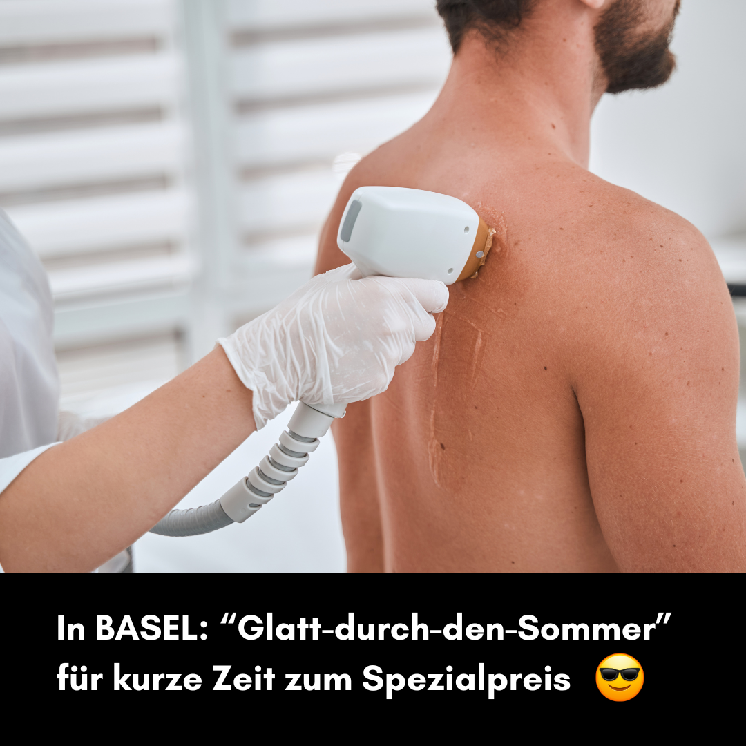 Männer Haarentfernung Basel