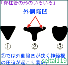 札幌市-脊柱管の狭窄⁻痛みやしびれ