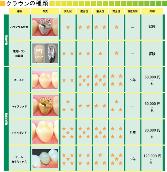 クラウンの種類
