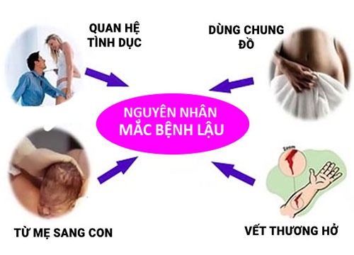 Bệnh lậu lây qua đường nào