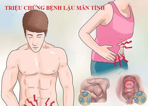 Tìm hiểu bệnh lậu mãn tính