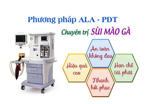 Phương pháp Ala-PDT