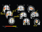 脳機能磁気共鳴画像