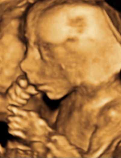 3D Babywatching 