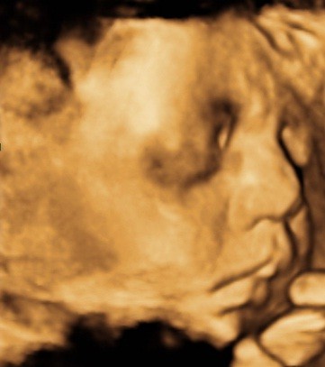 3D Babywatching 