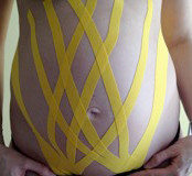 Physiotherapie in der Schwangerschaft, Taping
