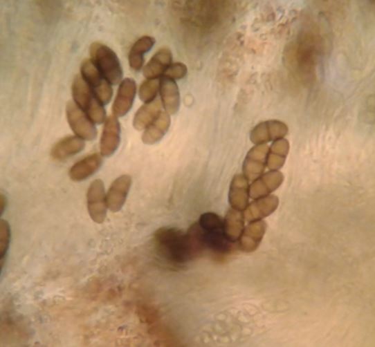 Spore bicellulari - 400x  -  (Physcia biziana)  - Claudio Malavasi
