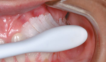 brush your gums to pass mouth swab test