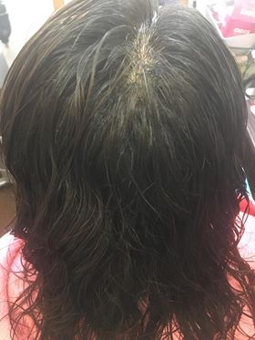 繰り返されるヘアアイロンで熱変性、タンパク変性をおこし、髪の炭化しています。