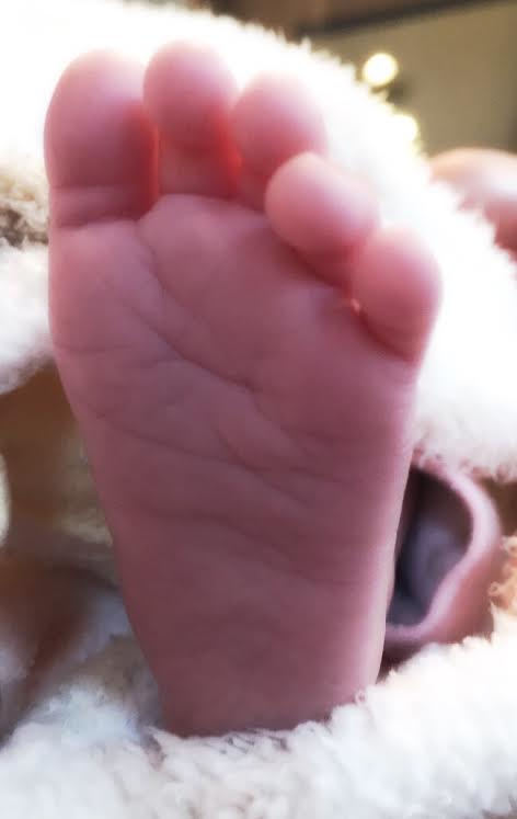 かわいい あかちゃん 正常な足 公式 福岡市 足と足ケア専門店 Dr ネイル爪革命福岡けやき通り店 巻き爪 魚の目