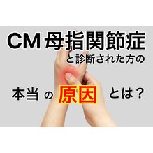 CM母指関節症と診断された方の本当の原因とは