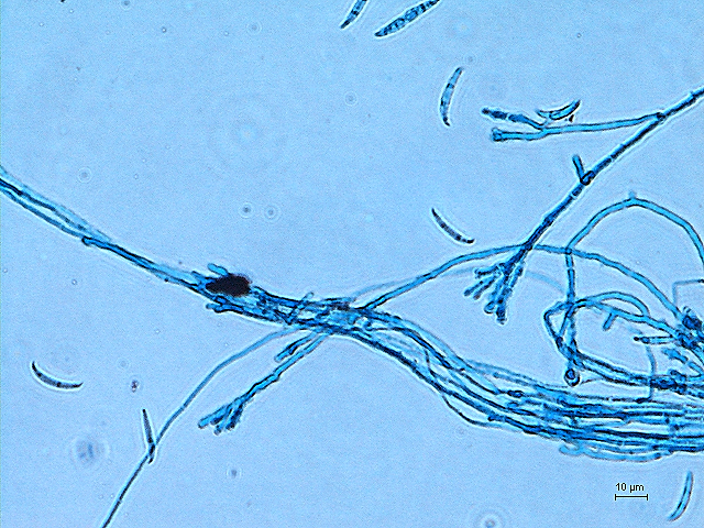 A fungus, Fusarium sp., producing a crescent-shaped spore called, macroconidia. Photo credits to Jia May