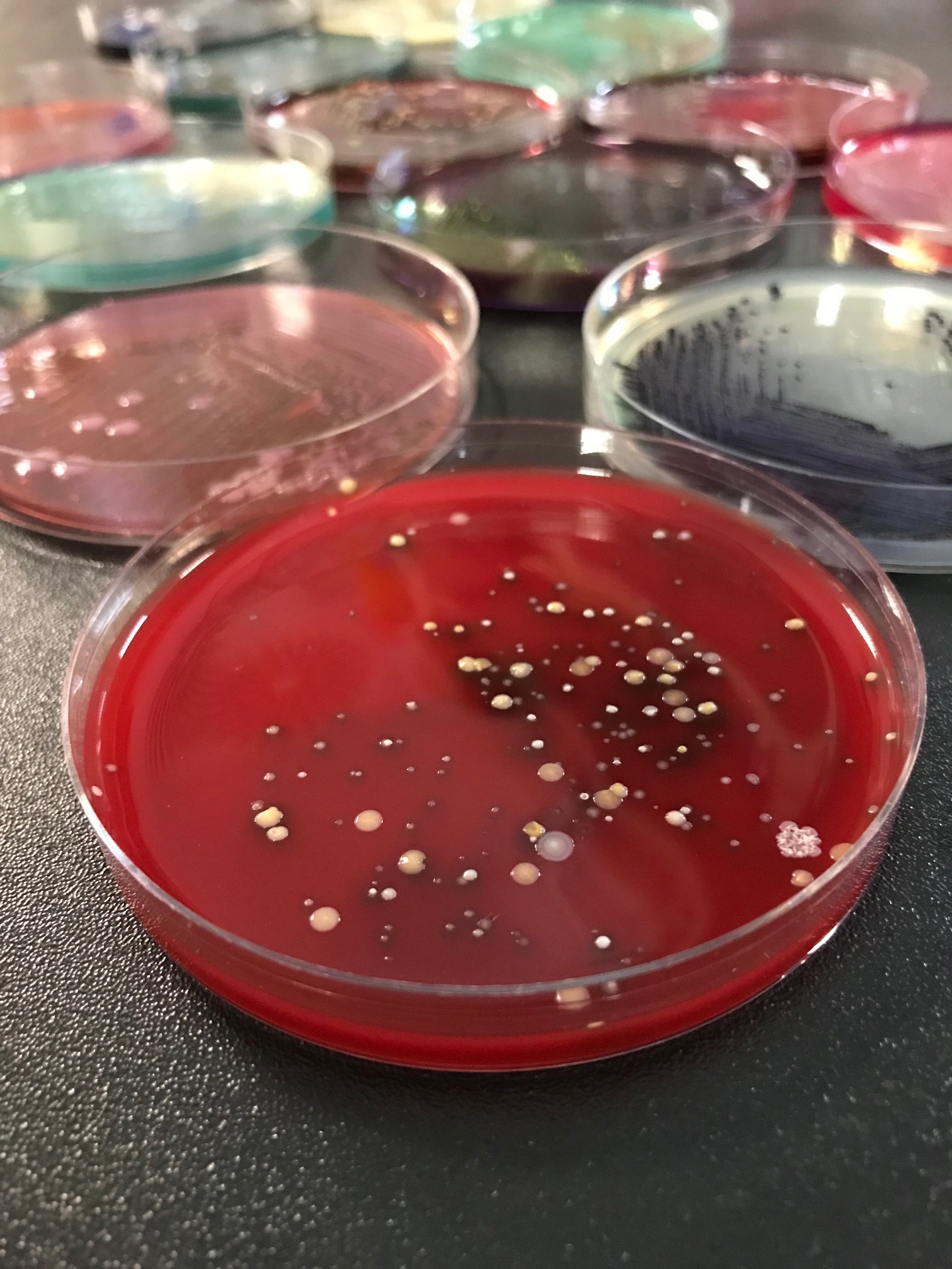 Throat microbes on blood agar. Photo credits to Calvin